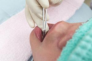 【2025年最新版】歯科のおすすめ情報と選び方ガイド ? 腕利きの歯医者を見つける完全戦略