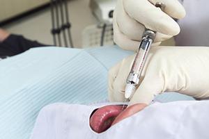 宇都宮のホワイトニングで有名な歯科医院