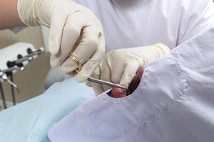 名古屋駅近くの矯正歯科選びのポイントと信頼できる医院一覧